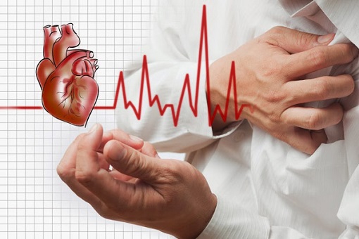 Rối loạn nhịp tim dẫn đến những cơn đau ngực