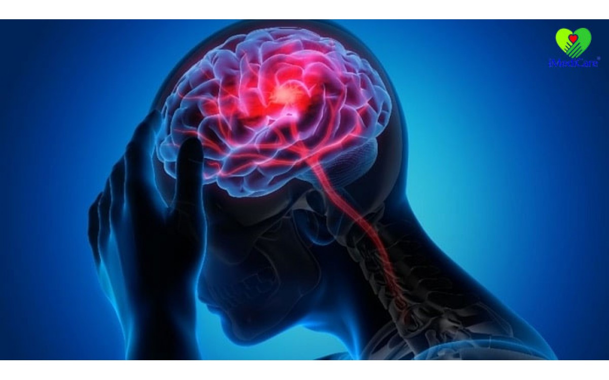 Sự thật ít người biết về đột quỵ tai biến mạch máu não